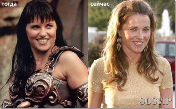 Celebridades – antes e depois - Parte II! | SOSVIP